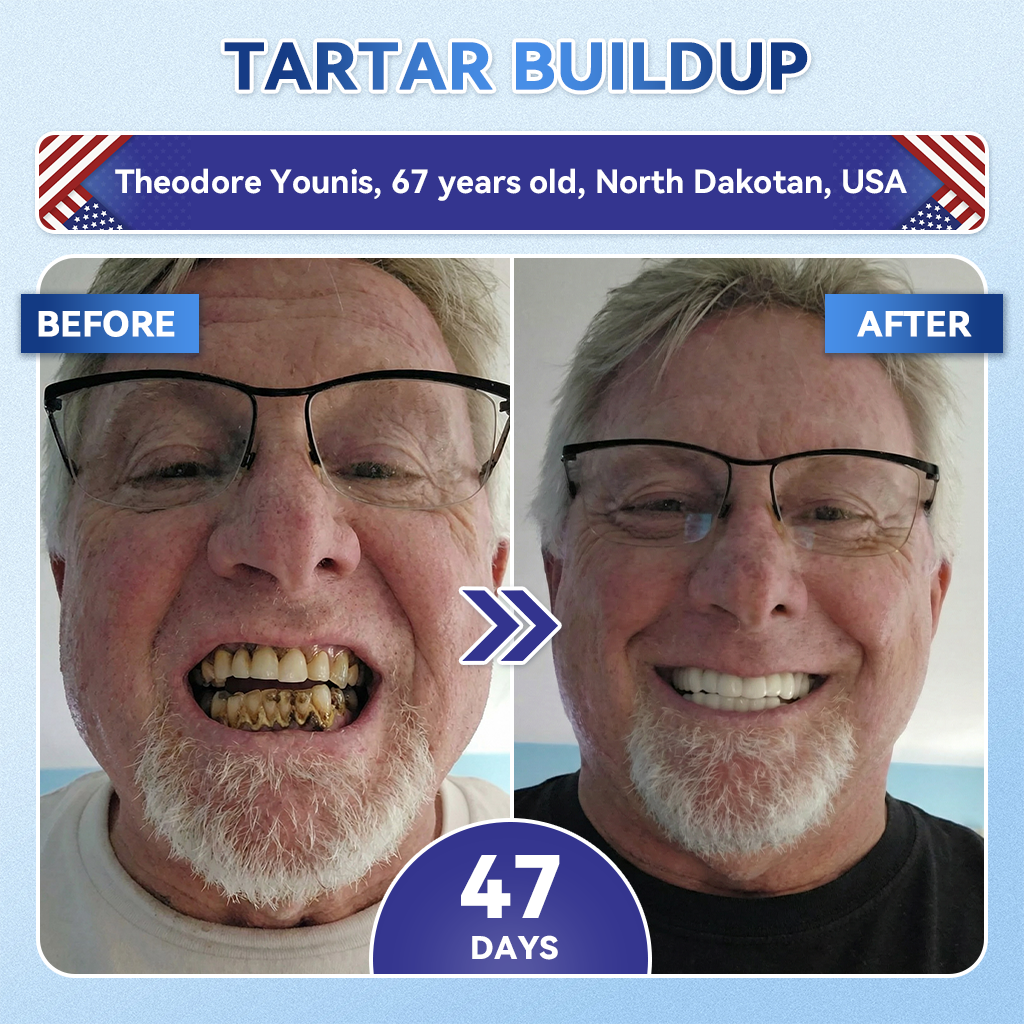 𝐆𝐥𝐢𝐦𝐦𝐞𝐫𝐥𝐲® 𝐓𝐢𝐝𝐞𝐠𝐥𝐮𝐬𝐢𝐛 𝐓𝐨𝐨𝐭𝐡 & 𝐆𝐮𝐦 𝐑𝐞𝐩𝐚𝐢𝐫 𝐌𝐢𝐜𝐫𝐨𝐧𝐞𝐞𝐝𝐥𝐞 𝐏𝐚𝐭𝐜𝐡 | 𝐀𝐝𝐯𝐚𝐧𝐜𝐞𝐝 𝐒𝐭𝐞𝐦-𝐂𝐞𝐥𝐥 𝐀𝐜𝐭𝐢𝐯𝐚𝐭𝐢𝐨𝐧 𝐓𝐞𝐞𝐭𝐡 𝐒𝐭𝐫𝐢𝐩𝐬 (𝐑𝐞𝐛𝐮𝐢𝐥𝐝 𝐄𝐧𝐚𝐦𝐞𝐥 & 𝐃𝐞𝐧𝐭𝐢𝐧 • 𝐒𝐭𝐫𝐞𝐧𝐠𝐭𝐡𝐞𝐧 𝐆𝐮𝐦𝐬 • 𝐄𝐫𝐚𝐝𝐢𝐜𝐚𝐭𝐞 𝐓𝐚𝐫𝐭𝐚𝐫 & 𝐎𝐝𝐨𝐫 • 𝐒𝐭𝐨𝐩 𝐓𝐨𝐨𝐭𝐡 𝐒𝐞𝐧𝐬𝐢𝐭𝐢𝐯𝐢𝐭𝐲) 🌿