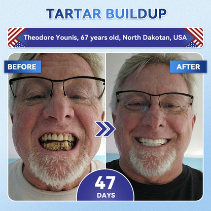 𝐆𝐥𝐢𝐦𝐦𝐞𝐫𝐥𝐲® 𝐓𝐢𝐝𝐞𝐠𝐥𝐮𝐬𝐢𝐛 𝐓𝐨𝐨𝐭𝐡 & 𝐆𝐮𝐦 𝐑𝐞𝐩𝐚𝐢𝐫 𝐌𝐢𝐜𝐫𝐨𝐧𝐞𝐞𝐝𝐥𝐞 𝐏𝐚𝐭𝐜𝐡 | 𝐀𝐝𝐯𝐚𝐧𝐜𝐞𝐝 𝐒𝐭𝐞𝐦-𝐂𝐞𝐥𝐥 𝐀𝐜𝐭𝐢𝐯𝐚𝐭𝐢𝐨𝐧 𝐓𝐞𝐞𝐭𝐡 𝐒𝐭𝐫𝐢𝐩𝐬 (𝐑𝐞𝐛𝐮𝐢𝐥𝐝 𝐄𝐧𝐚𝐦𝐞𝐥 & 𝐃𝐞𝐧𝐭𝐢𝐧 • 𝐒𝐭𝐫𝐞𝐧𝐠𝐭𝐡𝐞𝐧 𝐆𝐮𝐦𝐬 • 𝐄𝐫𝐚𝐝𝐢𝐜𝐚𝐭𝐞 𝐓𝐚𝐫𝐭𝐚𝐫 & 𝐎𝐝𝐨𝐫 • 𝐒𝐭𝐨𝐩 𝐓𝐨𝐨𝐭𝐡 𝐒𝐞𝐧𝐬𝐢𝐭𝐢𝐯𝐢𝐭𝐲) 🌿