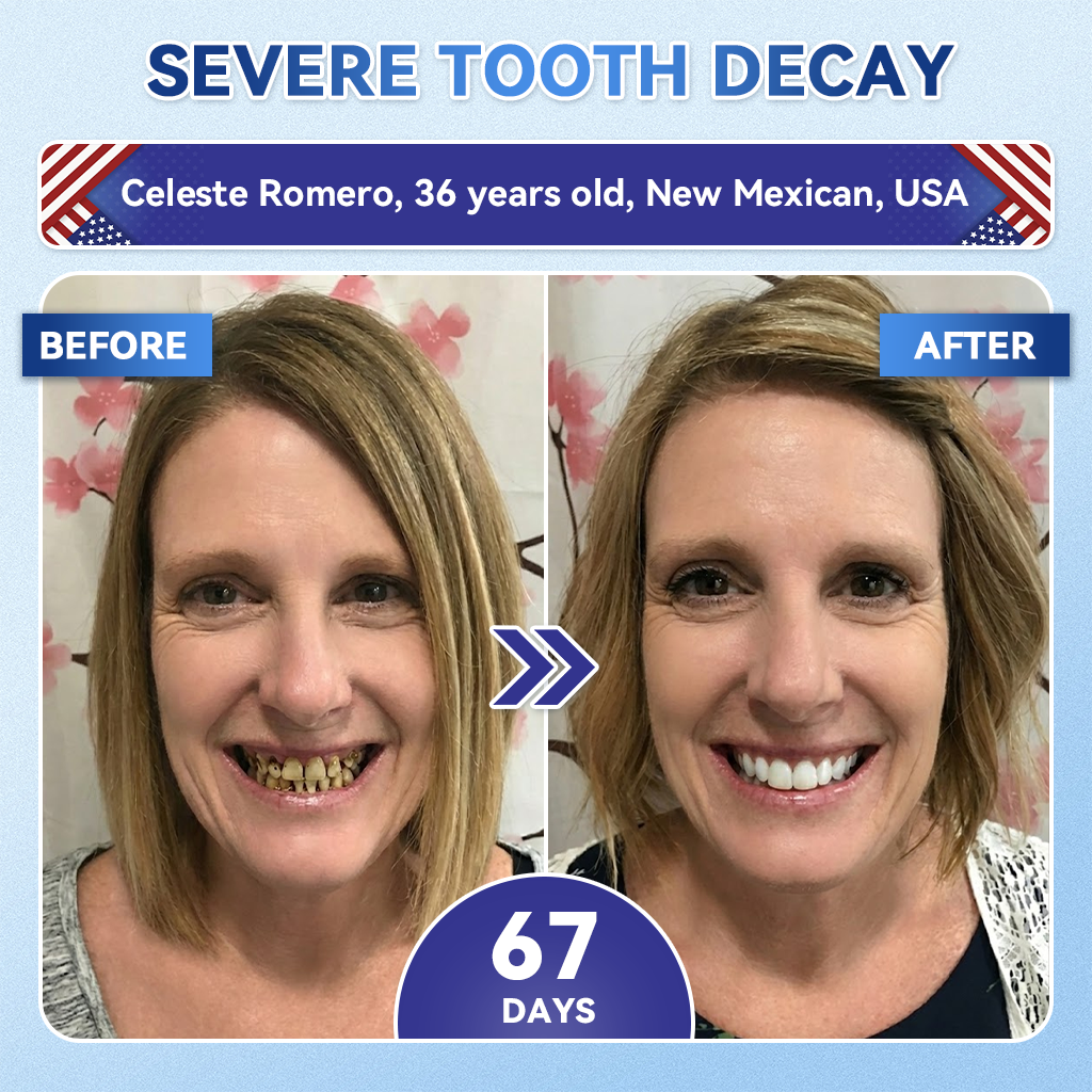 𝐆𝐥𝐢𝐦𝐦𝐞𝐫𝐥𝐲® 𝐓𝐢𝐝𝐞𝐠𝐥𝐮𝐬𝐢𝐛 𝐓𝐨𝐨𝐭𝐡 & 𝐆𝐮𝐦 𝐑𝐞𝐩𝐚𝐢𝐫 𝐌𝐢𝐜𝐫𝐨𝐧𝐞𝐞𝐝𝐥𝐞 𝐏𝐚𝐭𝐜𝐡 | 𝐀𝐝𝐯𝐚𝐧𝐜𝐞𝐝 𝐒𝐭𝐞𝐦-𝐂𝐞𝐥𝐥 𝐀𝐜𝐭𝐢𝐯𝐚𝐭𝐢𝐨𝐧 𝐓𝐞𝐞𝐭𝐡 𝐒𝐭𝐫𝐢𝐩𝐬 (𝐑𝐞𝐛𝐮𝐢𝐥𝐝 𝐄𝐧𝐚𝐦𝐞𝐥 & 𝐃𝐞𝐧𝐭𝐢𝐧 • 𝐒𝐭𝐫𝐞𝐧𝐠𝐭𝐡𝐞𝐧 𝐆𝐮𝐦𝐬 • 𝐄𝐫𝐚𝐝𝐢𝐜𝐚𝐭𝐞 𝐓𝐚𝐫𝐭𝐚𝐫 & 𝐎𝐝𝐨𝐫 • 𝐒𝐭𝐨𝐩 𝐓𝐨𝐨𝐭𝐡 𝐒𝐞𝐧𝐬𝐢𝐭𝐢𝐯𝐢𝐭𝐲) 🌿
