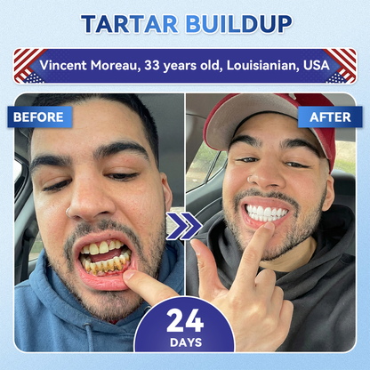 𝐆𝐥𝐢𝐦𝐦𝐞𝐫𝐥𝐲® 𝐓𝐢𝐝𝐞𝐠𝐥𝐮𝐬𝐢𝐛 𝐓𝐨𝐨𝐭𝐡 & 𝐆𝐮𝐦 𝐑𝐞𝐩𝐚𝐢𝐫 𝐌𝐢𝐜𝐫𝐨𝐧𝐞𝐞𝐝𝐥𝐞 𝐏𝐚𝐭𝐜𝐡 | 𝐀𝐝𝐯𝐚𝐧𝐜𝐞𝐝 𝐒𝐭𝐞𝐦-𝐂𝐞𝐥𝐥 𝐀𝐜𝐭𝐢𝐯𝐚𝐭𝐢𝐨𝐧 𝐓𝐞𝐞𝐭𝐡 𝐒𝐭𝐫𝐢𝐩𝐬 (𝐑𝐞𝐛𝐮𝐢𝐥𝐝 𝐄𝐧𝐚𝐦𝐞𝐥 & 𝐃𝐞𝐧𝐭𝐢𝐧 • 𝐒𝐭𝐫𝐞𝐧𝐠𝐭𝐡𝐞𝐧 𝐆𝐮𝐦𝐬 • 𝐄𝐫𝐚𝐝𝐢𝐜𝐚𝐭𝐞 𝐓𝐚𝐫𝐭𝐚𝐫 & 𝐎𝐝𝐨𝐫 • 𝐒𝐭𝐨𝐩 𝐓𝐨𝐨𝐭𝐡 𝐒𝐞𝐧𝐬𝐢𝐭𝐢𝐯𝐢𝐭𝐲) 🌿