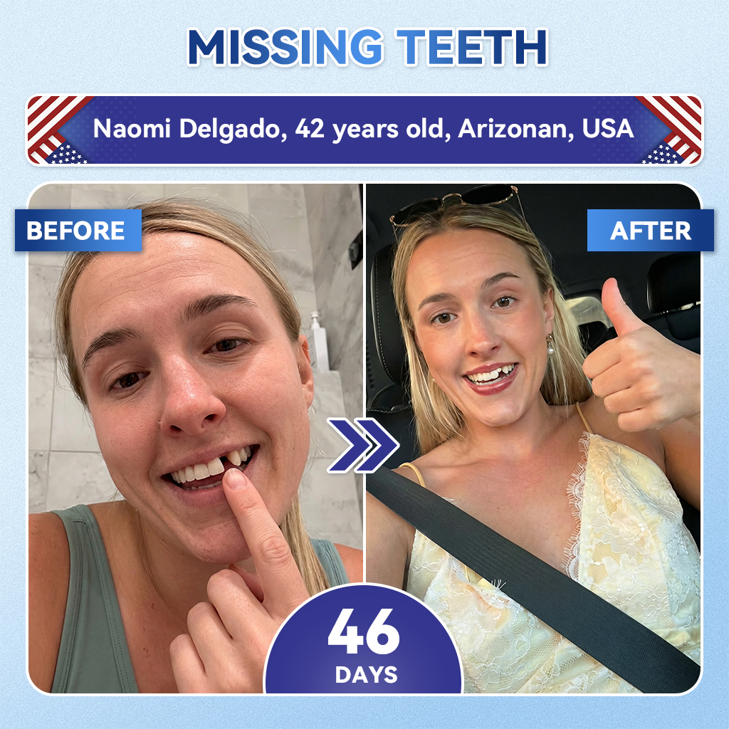 𝐆𝐥𝐢𝐦𝐦𝐞𝐫𝐥𝐲® 𝐓𝐢𝐝𝐞𝐠𝐥𝐮𝐬𝐢𝐛 𝐓𝐨𝐨𝐭𝐡 & 𝐆𝐮𝐦 𝐑𝐞𝐩𝐚𝐢𝐫 𝐌𝐢𝐜𝐫𝐨𝐧𝐞𝐞𝐝𝐥𝐞 𝐏𝐚𝐭𝐜𝐡 | 𝐀𝐝𝐯𝐚𝐧𝐜𝐞𝐝 𝐒𝐭𝐞𝐦-𝐂𝐞𝐥𝐥 𝐀𝐜𝐭𝐢𝐯𝐚𝐭𝐢𝐨𝐧 𝐓𝐞𝐞𝐭𝐡 𝐒𝐭𝐫𝐢𝐩𝐬 (𝐑𝐞𝐛𝐮𝐢𝐥𝐝 𝐄𝐧𝐚𝐦𝐞𝐥 & 𝐃𝐞𝐧𝐭𝐢𝐧 • 𝐒𝐭𝐫𝐞𝐧𝐠𝐭𝐡𝐞𝐧 𝐆𝐮𝐦𝐬 • 𝐄𝐫𝐚𝐝𝐢𝐜𝐚𝐭𝐞 𝐓𝐚𝐫𝐭𝐚𝐫 & 𝐎𝐝𝐨𝐫 • 𝐒𝐭𝐨𝐩 𝐓𝐨𝐨𝐭𝐡 𝐒𝐞𝐧𝐬𝐢𝐭𝐢𝐯𝐢𝐭𝐲) 🌿