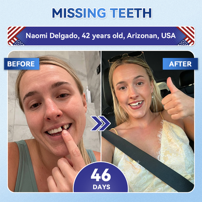 𝐆𝐥𝐢𝐦𝐦𝐞𝐫𝐥𝐲® 𝐓𝐢𝐝𝐞𝐠𝐥𝐮𝐬𝐢𝐛 𝐓𝐨𝐨𝐭𝐡 & 𝐆𝐮𝐦 𝐑𝐞𝐩𝐚𝐢𝐫 𝐌𝐢𝐜𝐫𝐨𝐧𝐞𝐞𝐝𝐥𝐞 𝐏𝐚𝐭𝐜𝐡 | 𝐀𝐝𝐯𝐚𝐧𝐜𝐞𝐝 𝐒𝐭𝐞𝐦-𝐂𝐞𝐥𝐥 𝐀𝐜𝐭𝐢𝐯𝐚𝐭𝐢𝐨𝐧 𝐓𝐞𝐞𝐭𝐡 𝐒𝐭𝐫𝐢𝐩𝐬 (𝐑𝐞𝐛𝐮𝐢𝐥𝐝 𝐄𝐧𝐚𝐦𝐞𝐥 & 𝐃𝐞𝐧𝐭𝐢𝐧 • 𝐒𝐭𝐫𝐞𝐧𝐠𝐭𝐡𝐞𝐧 𝐆𝐮𝐦𝐬 • 𝐄𝐫𝐚𝐝𝐢𝐜𝐚𝐭𝐞 𝐓𝐚𝐫𝐭𝐚𝐫 & 𝐎𝐝𝐨𝐫 • 𝐒𝐭𝐨𝐩 𝐓𝐨𝐨𝐭𝐡 𝐒𝐞𝐧𝐬𝐢𝐭𝐢𝐯𝐢𝐭𝐲) 🌿