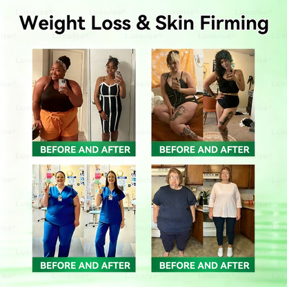𝑶𝒇𝒇𝒊𝒄𝒊𝒂𝒍 𝑺𝒕𝒐𝒓𝒆  |👩‍⚕️𝑳𝒖𝒙𝒂𝒓𝒊𝒔𝒆® 𝑴𝒐𝒓𝒊𝒏𝒈𝒂 & 𝑩𝒆𝒓𝒃𝒆𝒓𝒊𝒏𝒆 10-𝑰𝑵-1 𝑨𝒅𝒗𝒂𝒏𝒄𝒆𝒅 𝑵𝒂𝒏𝒐 𝑴𝒊𝒄𝒓𝒐𝒏𝒆𝒆𝒅𝒍𝒆 𝑷𝒂𝒕𝒄𝒉✅ (𝐎𝐧𝐜𝐞 𝐃𝐚𝐢𝐥𝐲, 𝐯𝐢𝐬𝐢𝐛𝐥𝐞 𝐜𝐡𝐚𝐧𝐠𝐞𝐬 𝐢𝐧 𝟕 𝐝𝐚𝐲𝐬）𝐎𝐛𝐞𝐬𝐢𝐭𝐲, 𝐃𝐢𝐚𝐛𝐞𝐭𝐞𝐬, 𝐒𝐥𝐞𝐞𝐩 𝐀𝐩𝐧𝐞𝐚, 𝐀𝐧𝐝 𝐉𝐨𝐢𝐧𝐭 𝐈𝐬𝐬𝐮𝐞𝐬🍀